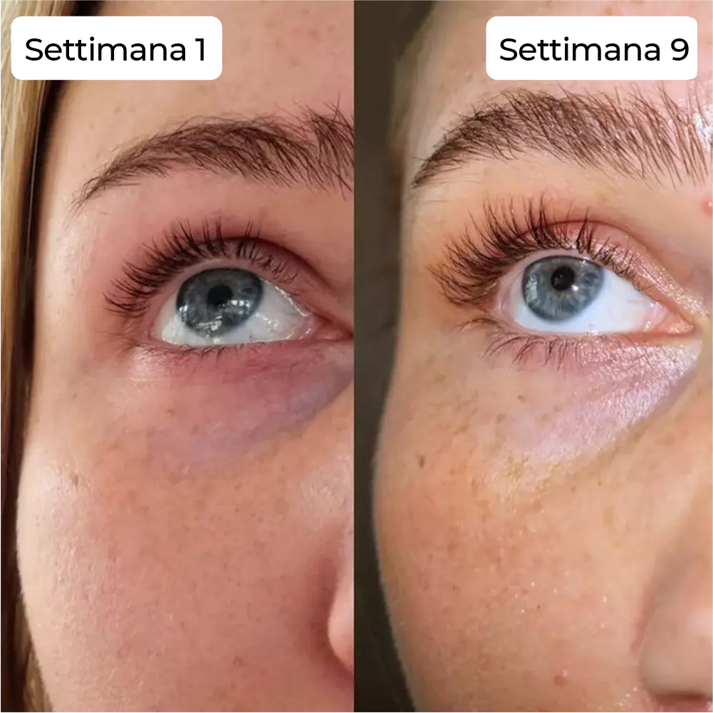 Before and After 2