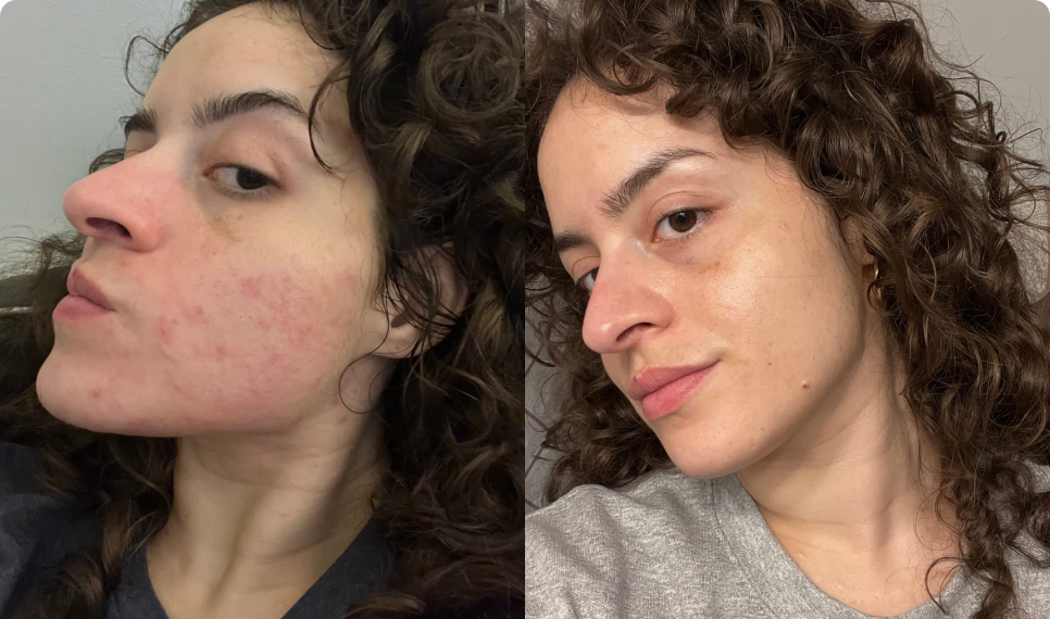 Joan Before After