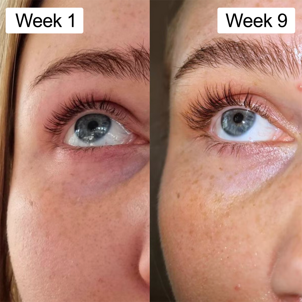 Before and After 2