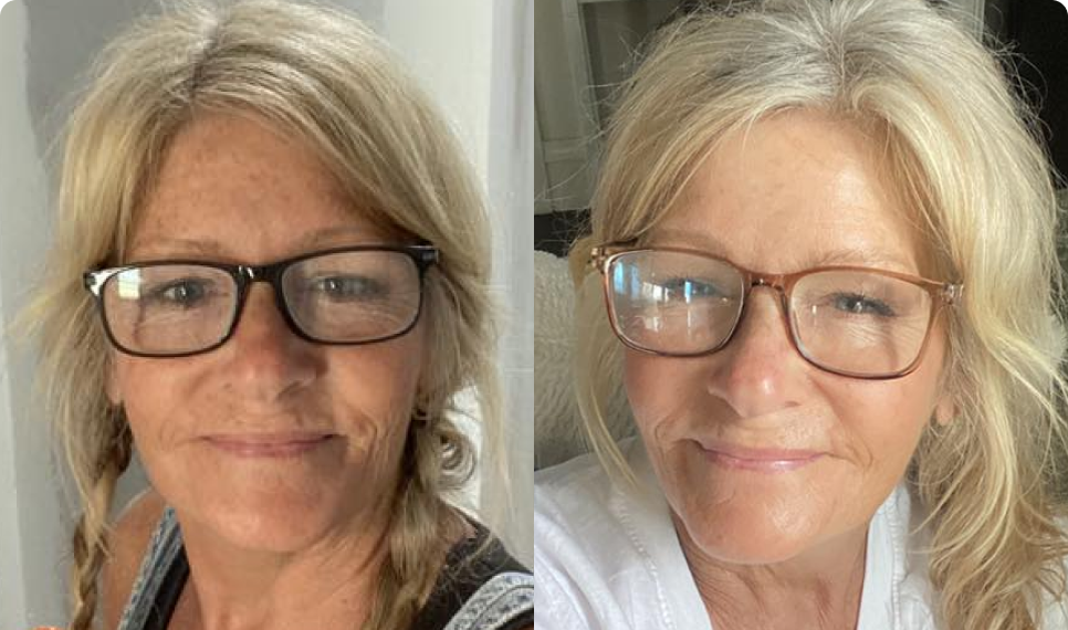 Joan Before After