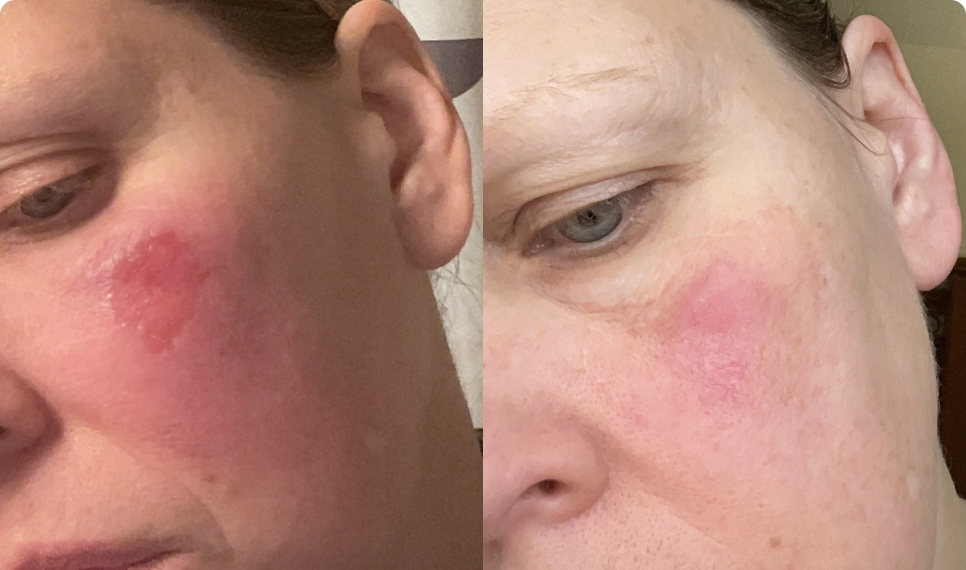 Joan Before After