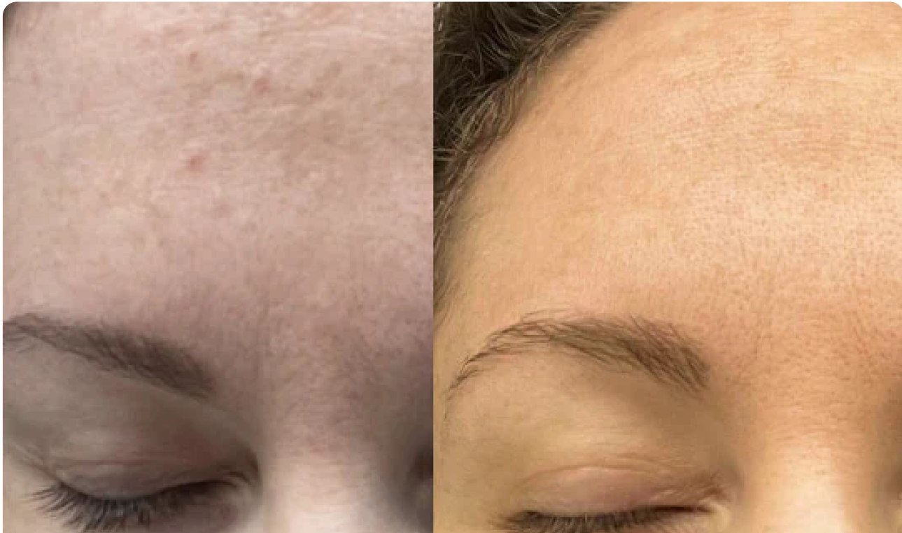Joan Before After